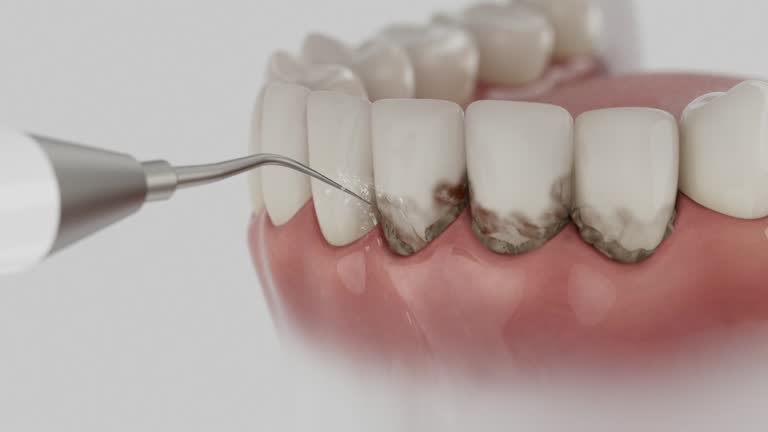 Reliable Dental Implants contractor in Tehachapi, CA by Smile Center Dentistry